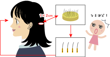 まつ毛植毛の方法