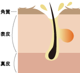 毛穴の開き