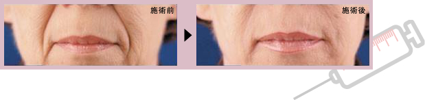 �u�q�A�������_�����v���Ì��� �ʐ^